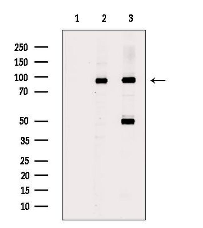 Acetyl-FOXO1 (Lys294) Antibody in Western Blot (WB)