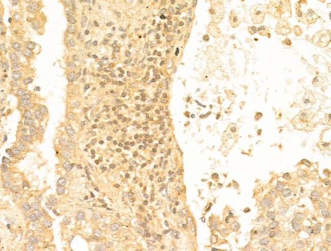 Acetyl-FOXO1 (Lys294) Antibody in Immunohistochemistry (Paraffin) (IHC (P))