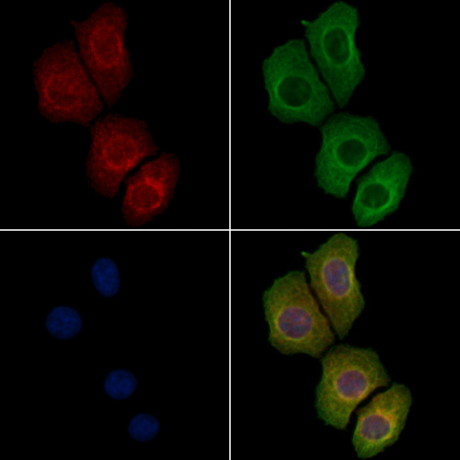 Phospho-DDR1 (Tyr513) Antibody in Immunocytochemistry (ICC/IF)