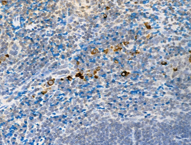 Phospho-DDR1 (Tyr513) Antibody in Immunohistochemistry (Paraffin) (IHC (P))