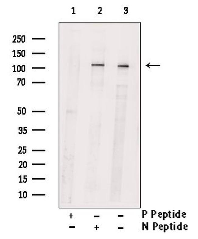 Phospho-PKD2 (Ser812) Antibody in Western Blot (WB)