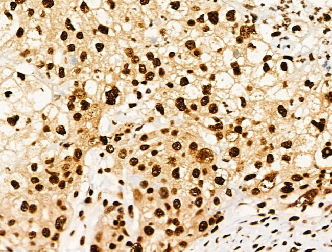 Phospho-RUNX1 (Ser249) Antibody in Immunohistochemistry (Paraffin) (IHC (P))