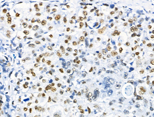 Phospho-RUNX1 (Ser249) Antibody in Immunohistochemistry (Paraffin) (IHC (P))