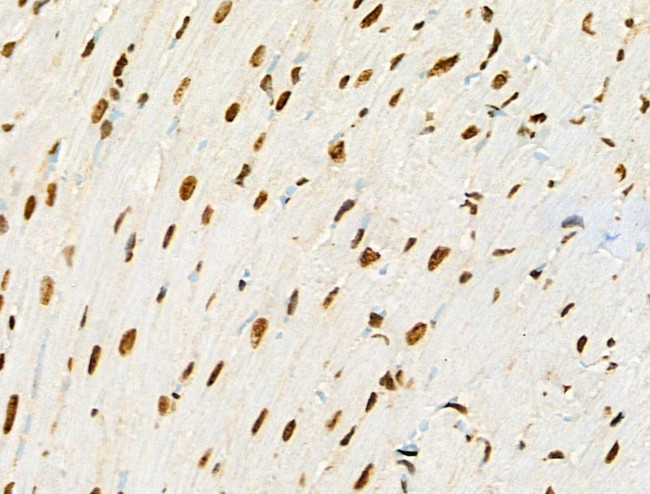 Phospho-RUNX1 (Ser249) Antibody in Immunohistochemistry (Paraffin) (IHC (P))