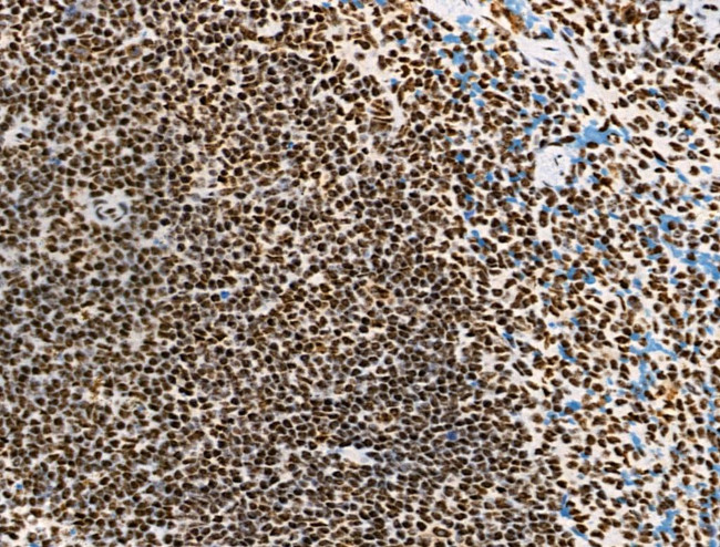 Phospho-RUNX1 (Ser249) Antibody in Immunohistochemistry (Paraffin) (IHC (P))