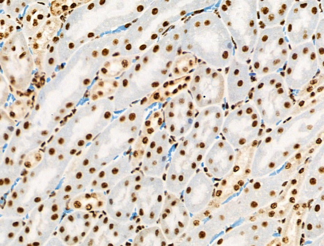 Phospho-RUNX1 (Ser249) Antibody in Immunohistochemistry (Paraffin) (IHC (P))