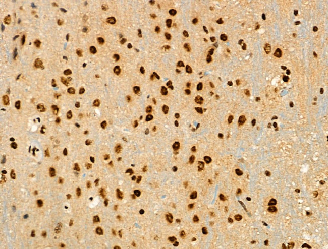 Phospho-RUNX1 (Ser249) Antibody in Immunohistochemistry (Paraffin) (IHC (P))