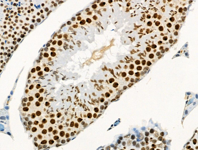 Phospho-RUNX1 (Ser249) Antibody in Immunohistochemistry (Paraffin) (IHC (P))