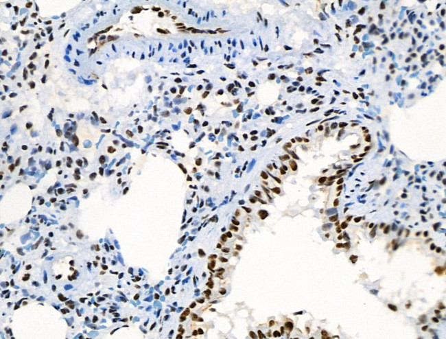 Phospho-RUNX1 (Ser249) Antibody in Immunohistochemistry (Paraffin) (IHC (P))