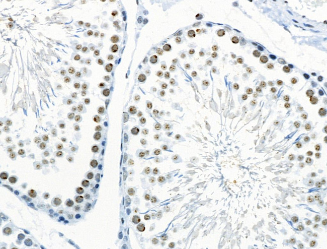 Phospho-RUNX1 (Ser249) Antibody in Immunohistochemistry (Paraffin) (IHC (P))