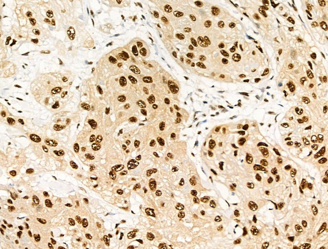 Phospho-RUNX1 (Ser249) Antibody in Immunohistochemistry (Paraffin) (IHC (P))