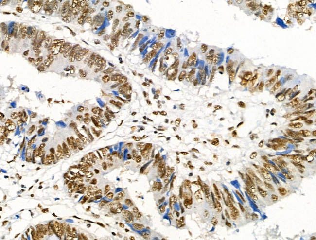 Phospho-RUNX1 (Ser249) Antibody in Immunohistochemistry (Paraffin) (IHC (P))