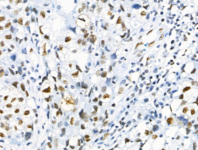 Phospho-RUNX1 (Ser249) Antibody in Immunohistochemistry (Paraffin) (IHC (P))