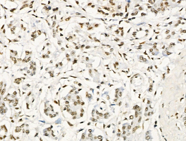 Phospho-RUNX1 (Ser249) Antibody in Immunohistochemistry (Paraffin) (IHC (P))