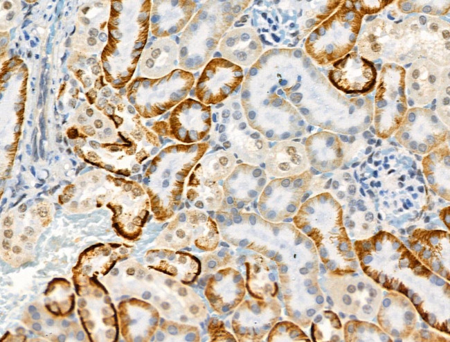 Phospho-AS160 (Ser318) Antibody in Immunohistochemistry (Paraffin) (IHC (P))