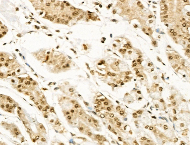Phospho-BCL9L (Ser915) Antibody in Immunohistochemistry (Paraffin) (IHC (P))