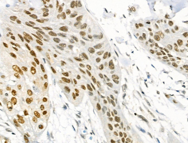 Phospho-BCL9L (Ser915) Antibody in Immunohistochemistry (Paraffin) (IHC (P))