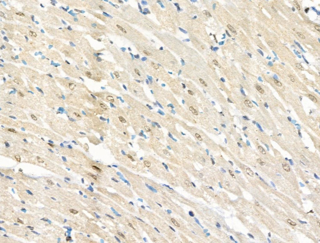 Phospho-BCL9L (Ser915) Antibody in Immunohistochemistry (Paraffin) (IHC (P))