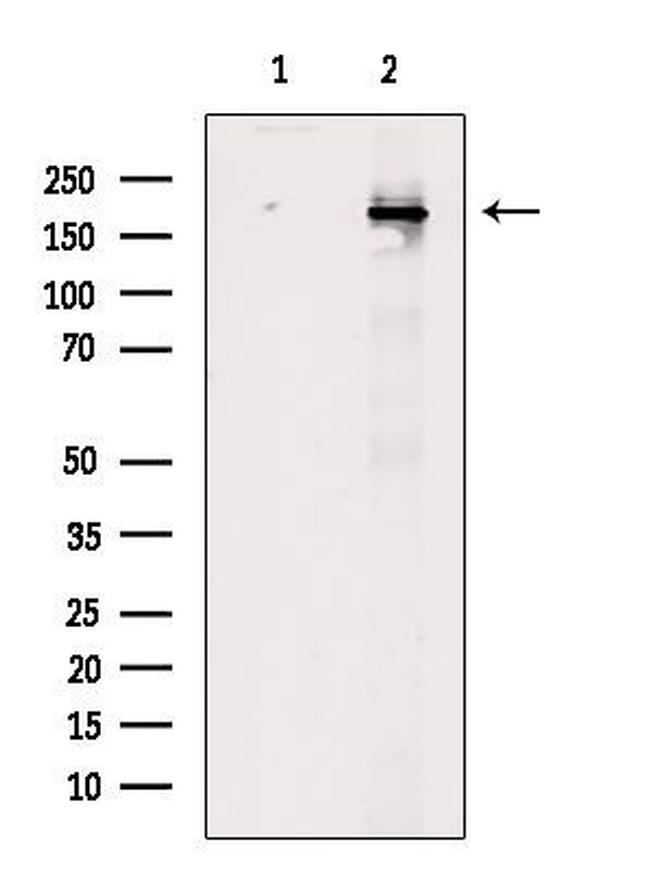 Phospho-BCL9L (Ser915) Antibody in Western Blot (WB)