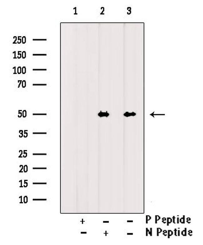 Phospho-CaMKII alpha/beta/delta (Tyr231) Antibody in Western Blot (WB)