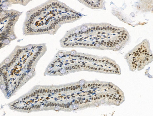 Phospho-CENPA (Ser7) Antibody in Immunohistochemistry (Paraffin) (IHC (P))