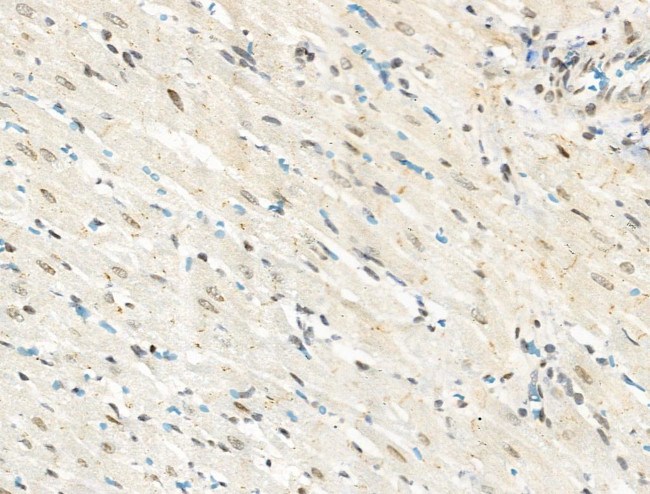 Phospho-CENPA (Ser7) Antibody in Immunohistochemistry (Paraffin) (IHC (P))