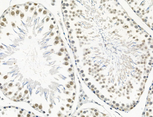 Phospho-CENPA (Ser7) Antibody in Immunohistochemistry (Paraffin) (IHC (P))