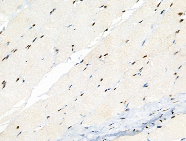 Phospho-CENPA (Ser7) Antibody in Immunohistochemistry (Paraffin) (IHC (P))