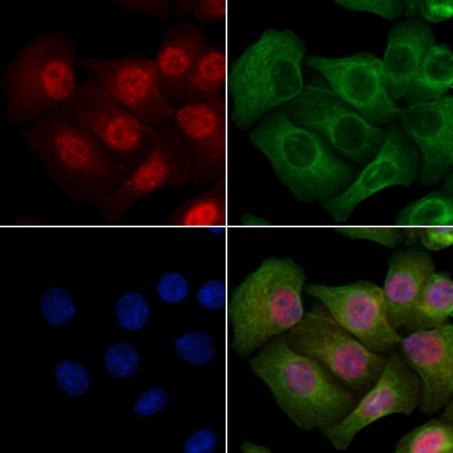 Phospho-CTDSPL2 (Ser104) Antibody in Immunocytochemistry (ICC/IF)