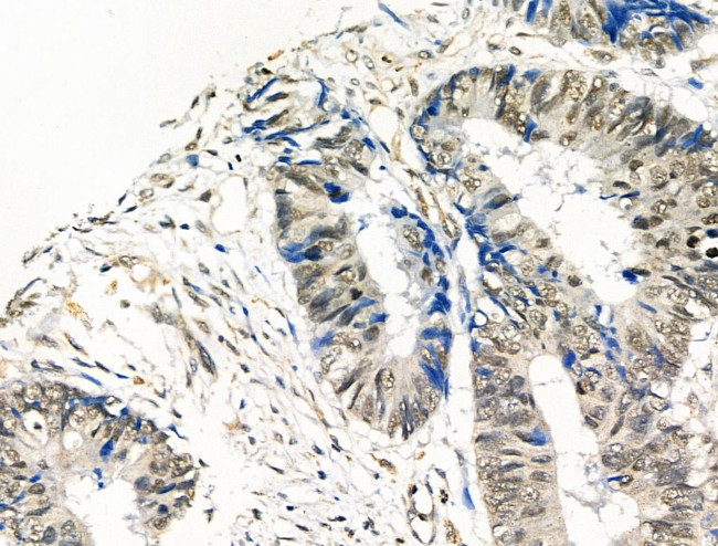 Phospho-CTDSPL2 (Ser104) Antibody in Immunohistochemistry (Paraffin) (IHC (P))