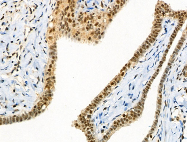 Phospho-CTDSPL2 (Ser104) Antibody in Immunohistochemistry (Paraffin) (IHC (P))