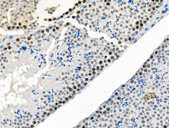 Phospho-CTDSPL2 (Ser104) Antibody in Immunohistochemistry (Paraffin) (IHC (P))