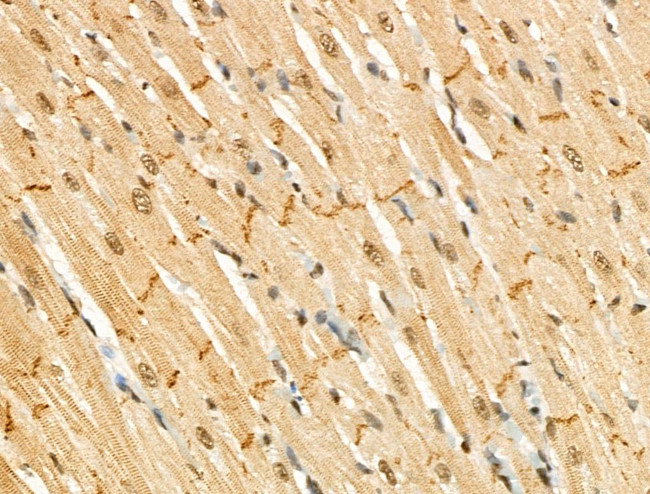 Phospho-CTDSPL2 (Ser104) Antibody in Immunohistochemistry (Paraffin) (IHC (P))