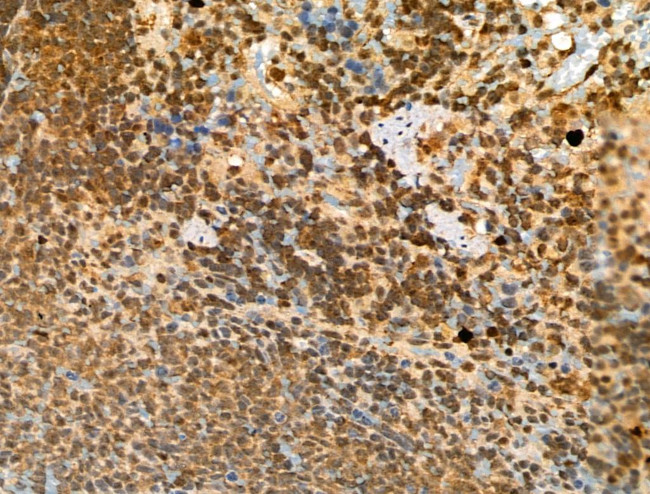 Phospho-CTDSPL2 (Ser104) Antibody in Immunohistochemistry (Paraffin) (IHC (P))