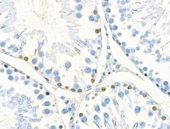 Phospho-CTDSPL2 (Ser104) Antibody in Immunohistochemistry (Paraffin) (IHC (P))