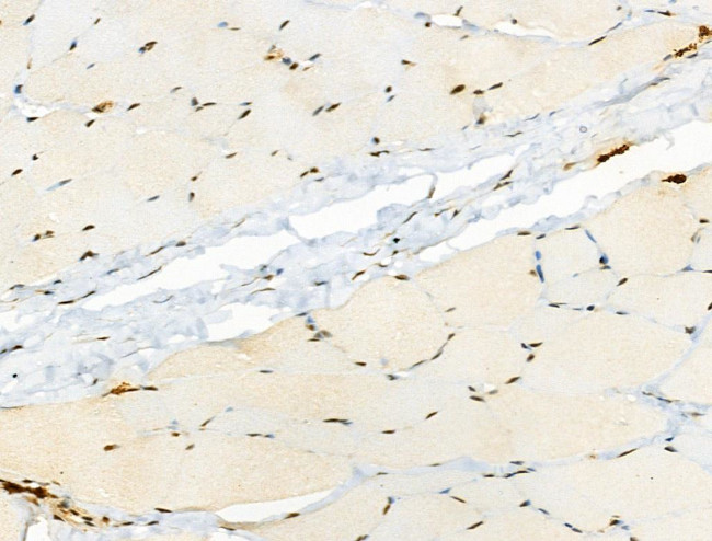 Phospho-CTDSPL2 (Ser104) Antibody in Immunohistochemistry (Paraffin) (IHC (P))