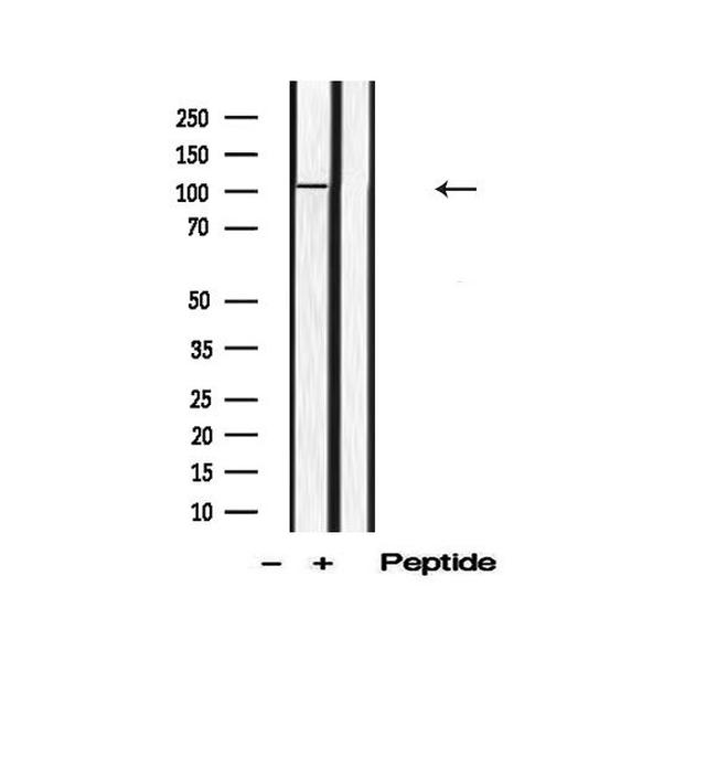 Phospho-DAB1 (Tyr220) Antibody in Western Blot (WB)