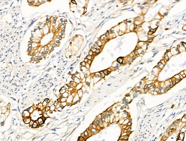 Phospho-FOXO3A (Ser413) Antibody in Immunohistochemistry (Paraffin) (IHC (P))