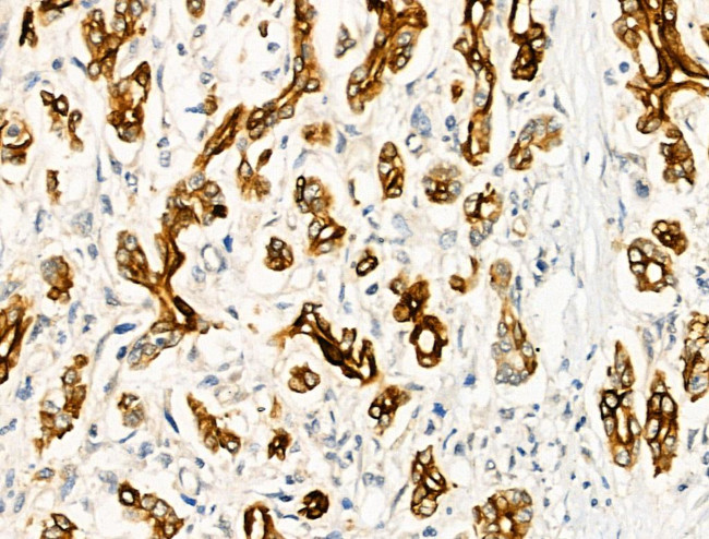 Phospho-FOXO3A (Ser413) Antibody in Immunohistochemistry (Paraffin) (IHC (P))