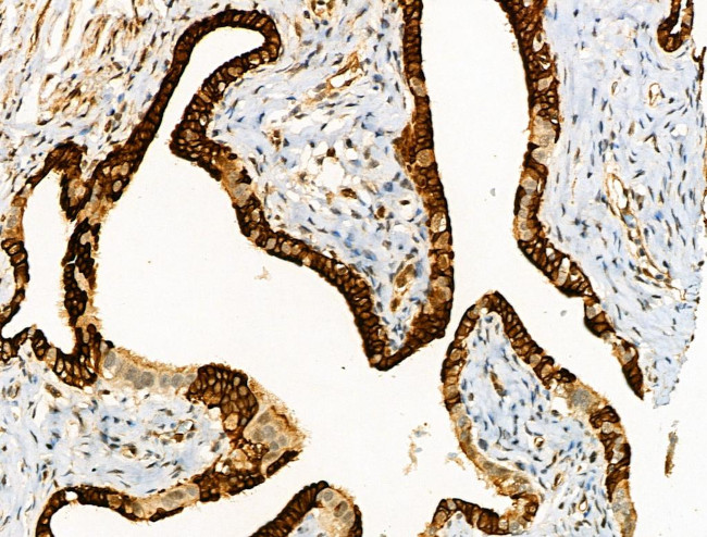 Phospho-FOXO3A (Ser413) Antibody in Immunohistochemistry (Paraffin) (IHC (P))