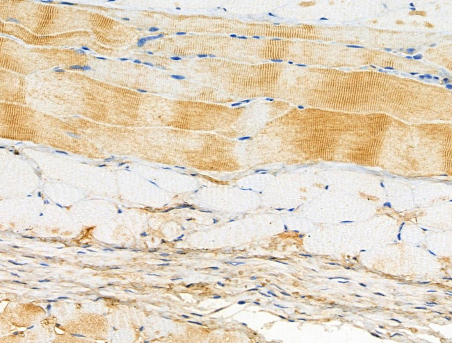 Phospho-FOXO3A (Ser413) Antibody in Immunohistochemistry (Paraffin) (IHC (P))