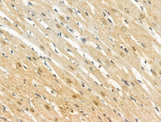 Phospho-FOXO3A (Ser413) Antibody in Immunohistochemistry (Paraffin) (IHC (P))