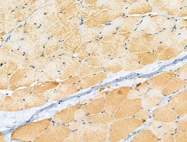 Phospho-FOXO3A (Ser413) Antibody in Immunohistochemistry (Paraffin) (IHC (P))