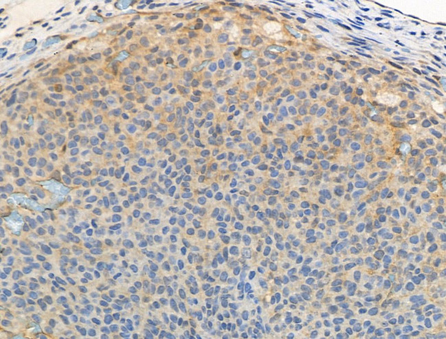 Phospho-FOXO3A (Ser413) Antibody in Immunohistochemistry (Paraffin) (IHC (P))