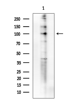 Phospho-FOXO3A (Ser413) Antibody in Western Blot (WB)