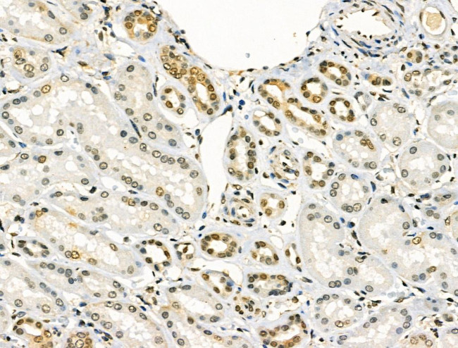 Phospho-FOXO3A (Ser7) Antibody in Immunohistochemistry (Paraffin) (IHC (P))