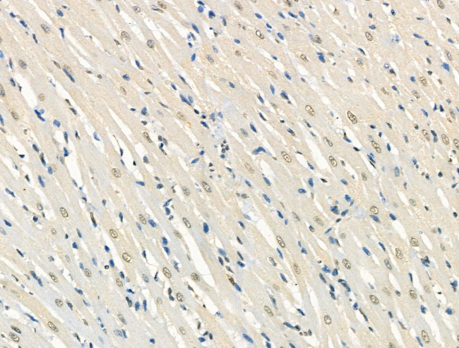 Phospho-FOXO3A (Ser7) Antibody in Immunohistochemistry (Paraffin) (IHC (P))