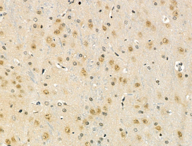 Phospho-FOXO3A (Ser7) Antibody in Immunohistochemistry (Paraffin) (IHC (P))