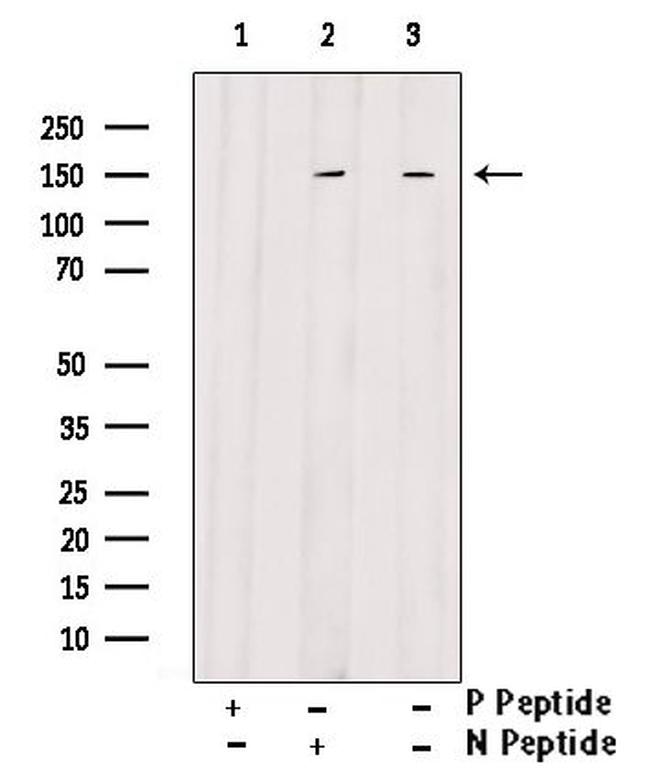 Phospho-SAPAP1 (Ser346) Antibody in Western Blot (WB)