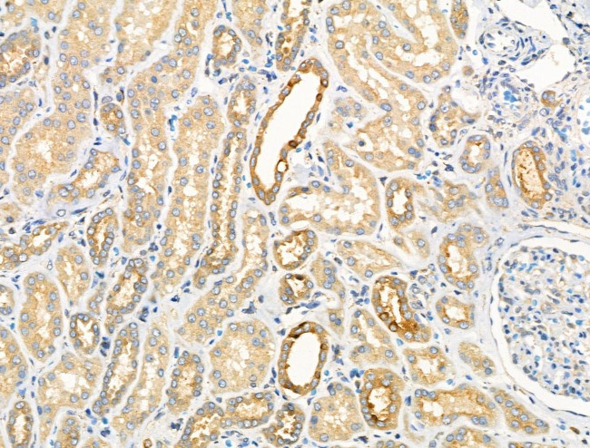 Phospho-GRB10 (Ser476) Antibody in Immunohistochemistry (Paraffin) (IHC (P))